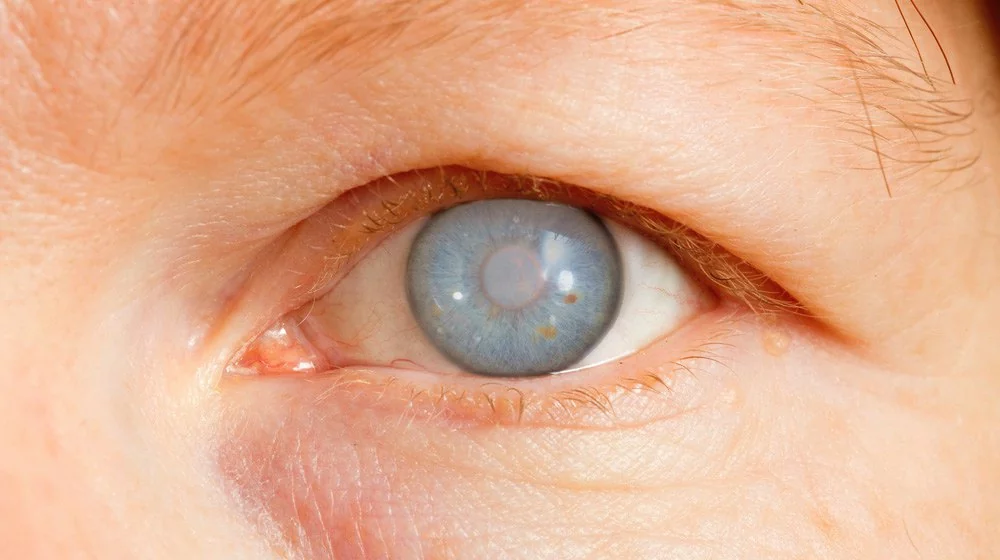 болезни глаз у человека